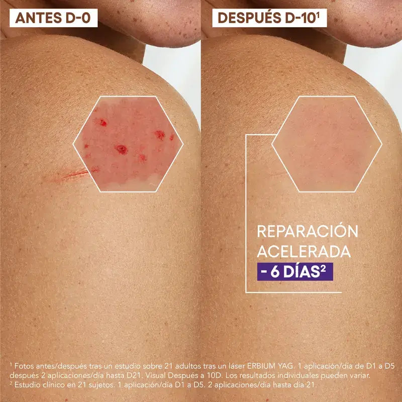 A-Derma Exomega Epithelial Ah Ultra-Repairing Anti-Narben-Creme 40 ml