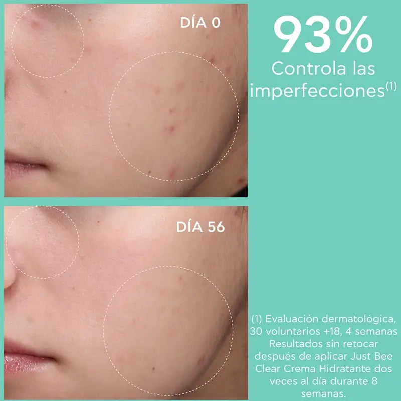 Apivita Just Bee Clear Mattierende Anti-Perfektionscreme, 40 ml