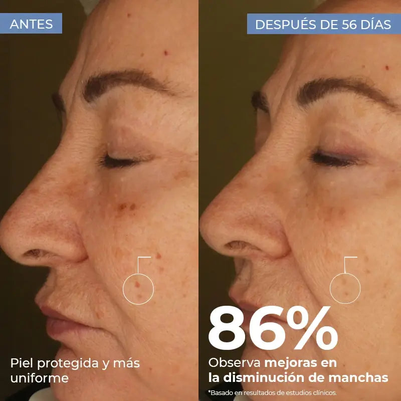 Arganour Gesichts-Porzellan Anti-Blemish Serum, 30 Ml