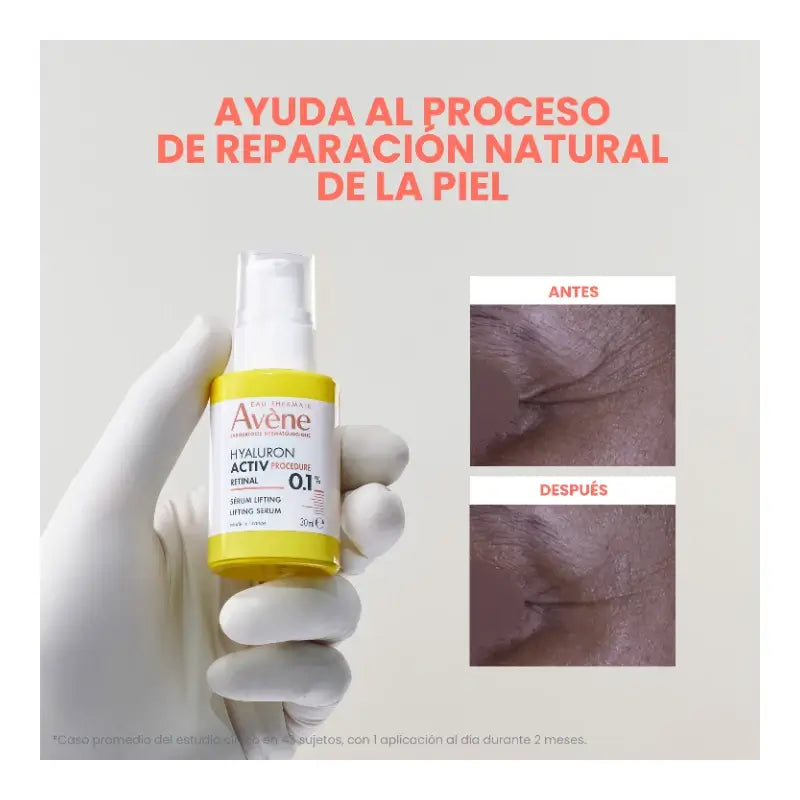 Avène Hyaluron Activ Procedure Lifting-Serum 0,1 % Retinal 30 ml
