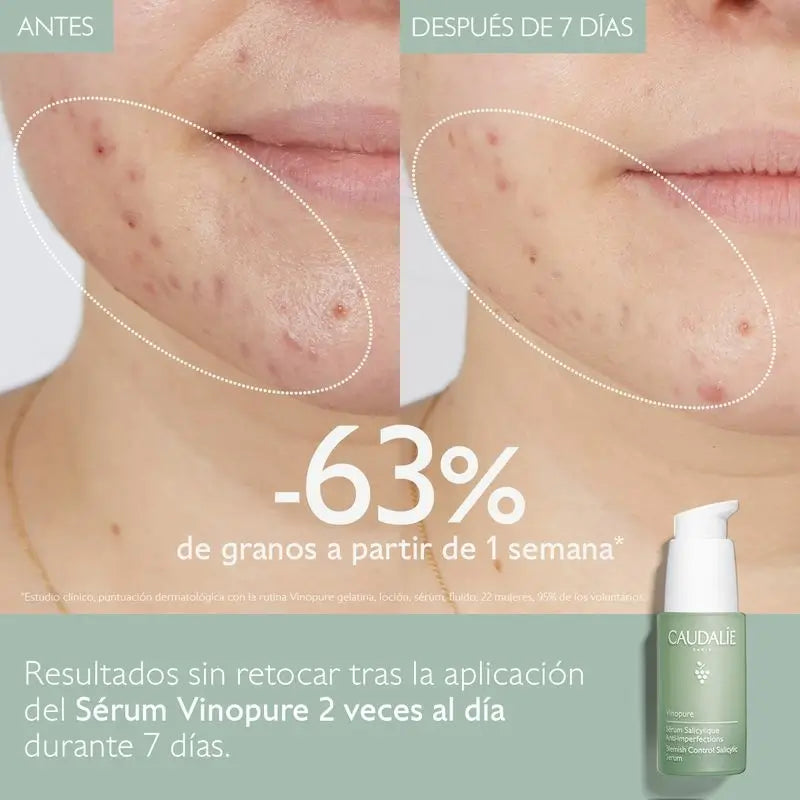Caudalíe Vinopure Anti-Unvollkommenheiten Salicyl-Serum - 30 ml