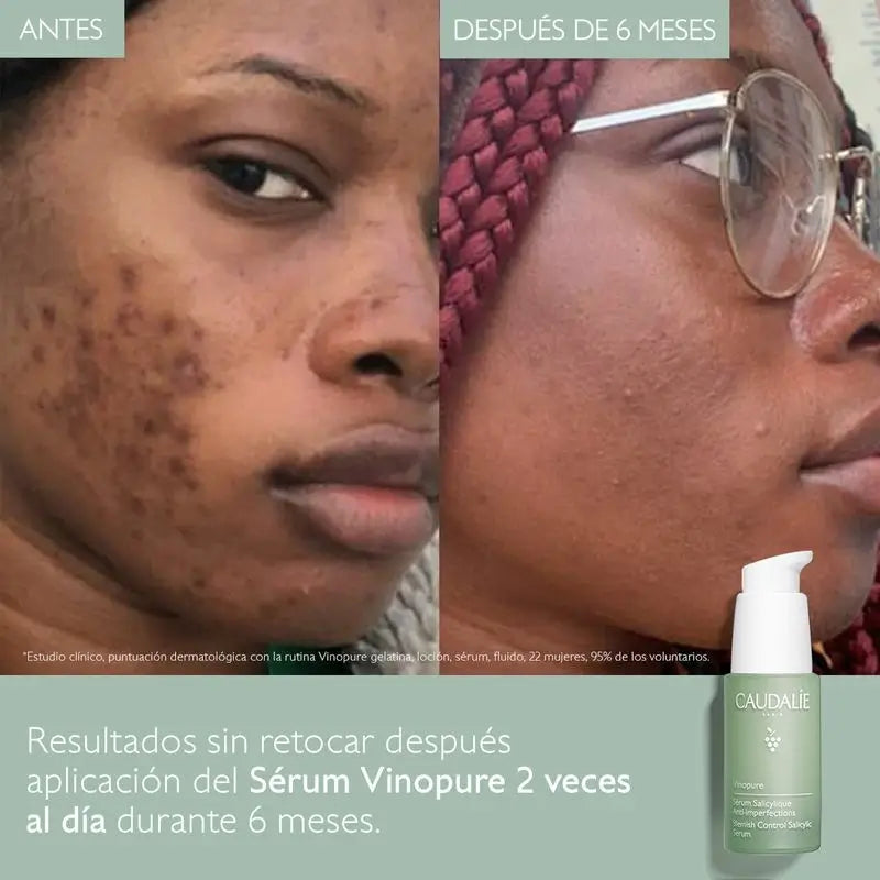 Caudalíe Vinopure Anti-Unvollkommenheiten Salicyl-Serum - 30 ml