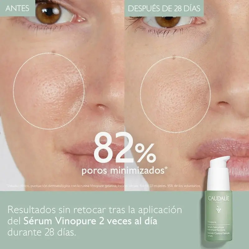 Caudalíe Vinopure Anti-Unvollkommenheiten Salicyl-Serum - 30 ml