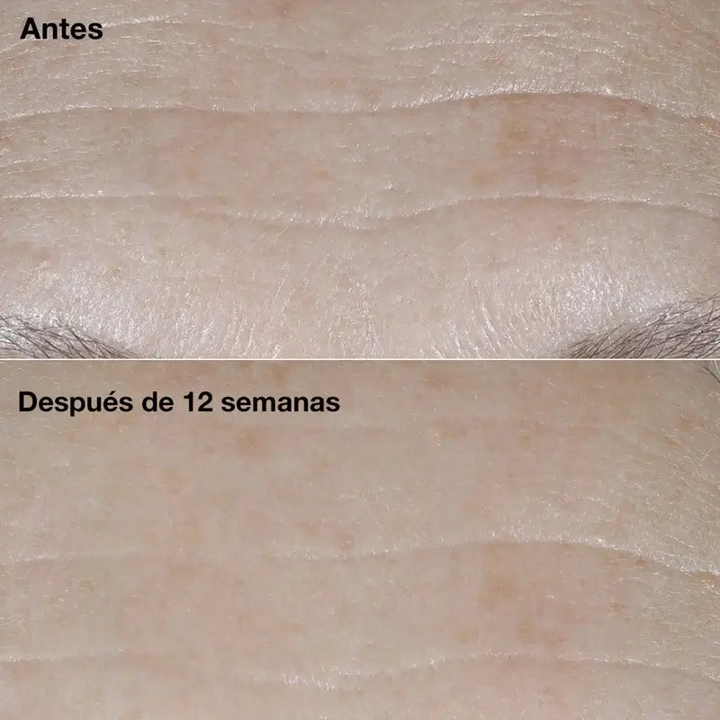 Clinique Smart Clinical Repair Anti-Ageing Creme SPF30, 50 ml