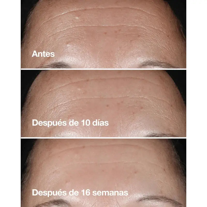 Clinique Smart Serum Anti-Ageing Filler and Smoother, 50 ml