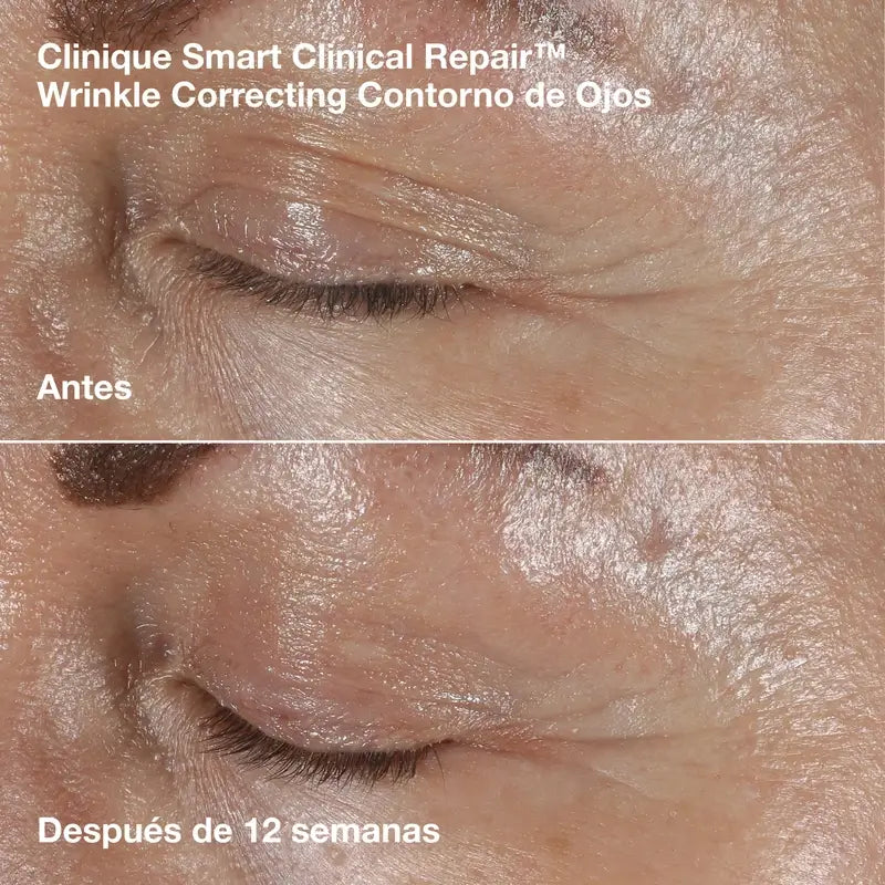 Clinique Day-to-Night De-Aging-Set