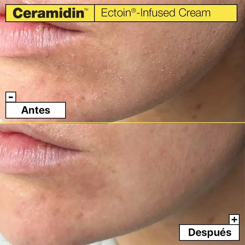 Dr. Jart+ Ceramidin Feuchtigkeitsspendende Gesichtscreme mit Ectoin, 50 ml