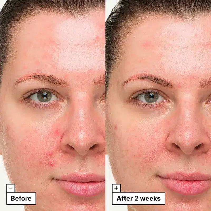 Dr.Jart+ Beruhigende Behandlungscreme-Gel, 30 ml
