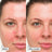 Dr.Jart+ Beruhigende Behandlungscreme-Gel, 30 ml