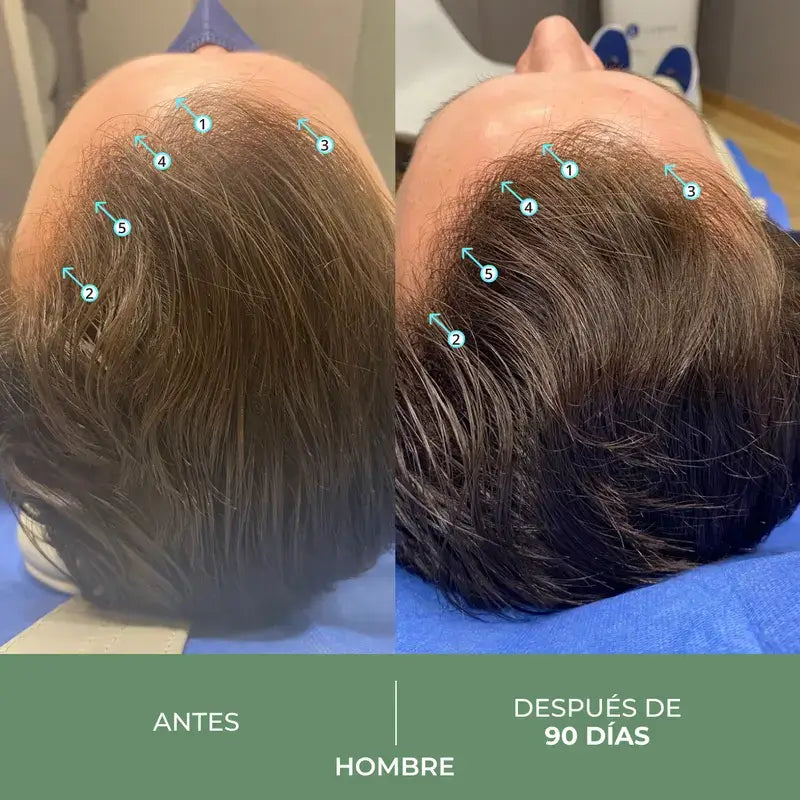 Ds Laboratories Revita Cbd Antioxidans & Stimulierendes Anti-Haarausfall Shampoo, 205 ml