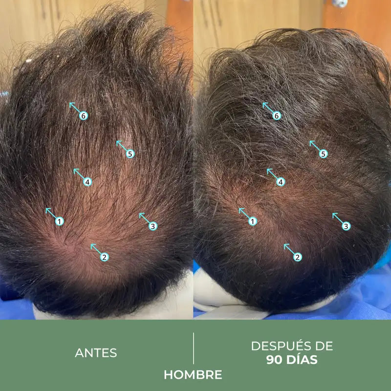 Ds Laboratories Revita Cbd Antioxidans & Stimulierendes Anti-Haarausfall Shampoo, 205 ml