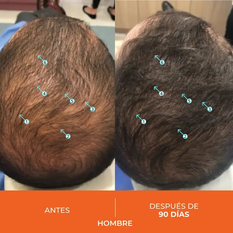 Ds Laboratories Revita Anti-Haarausfall Tabletten, 90 Stück