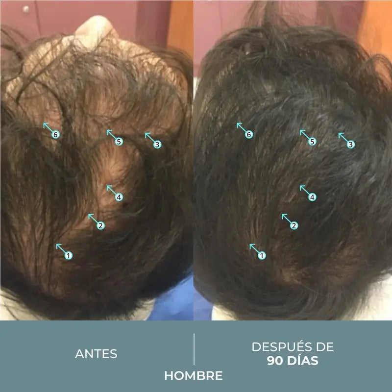 Ds Laboratories Revita Sod Anti-Haarausfall Tabletten, 30 Stück