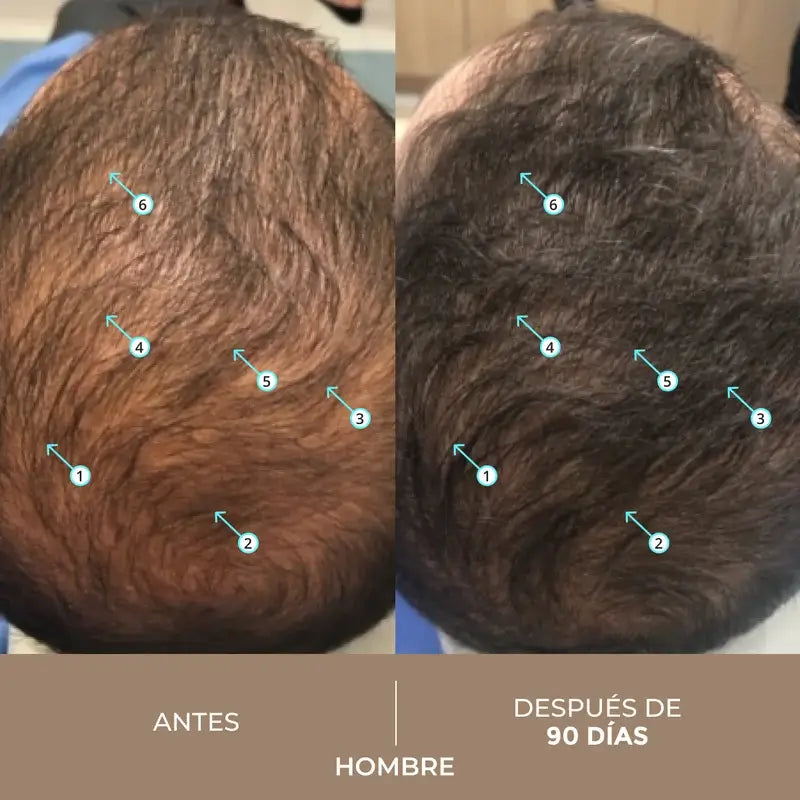 Ds Laboratories Spectral Lotion Dnc-N 3 Monate Haarausfall Behandlung mit Nanoxidil® 5%, 180 ml