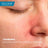 Ducray Kelual Ds Beruhigende Gesichtscreme , 40 ml
