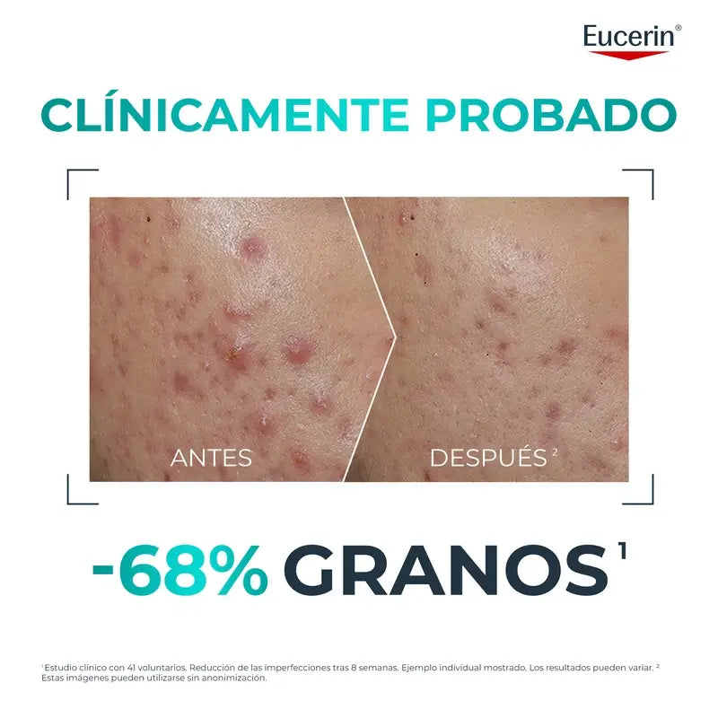 Eucerin Dermopure Clinical Probiom8-Set