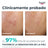 Eucerin Dermopure Peeling 10% Hydroxy-Säuren, 40 ml