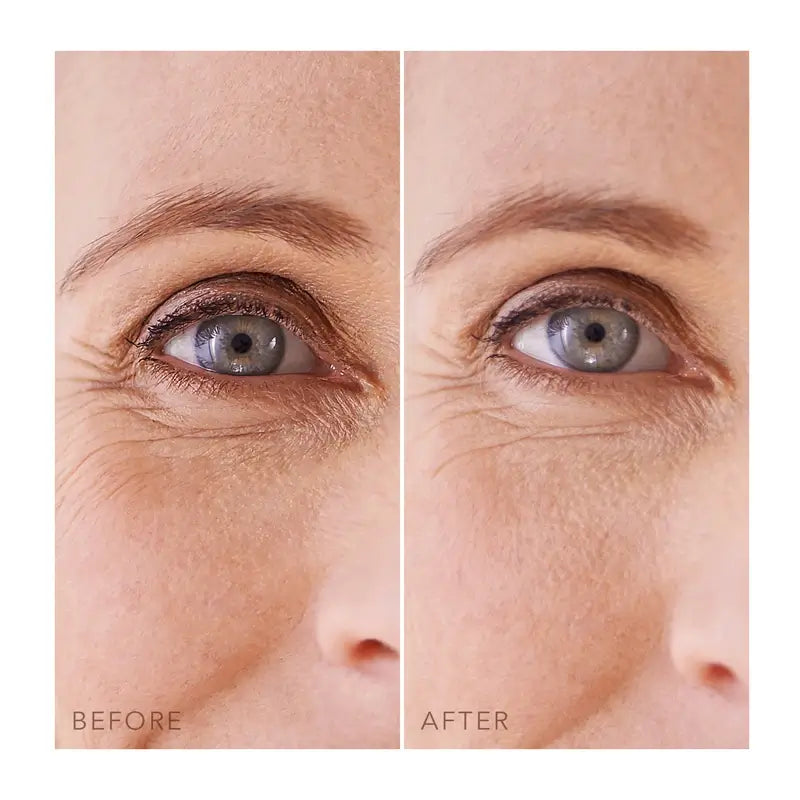 Foreo Iris™ Unter-Augen-Pflaster 60 Stück