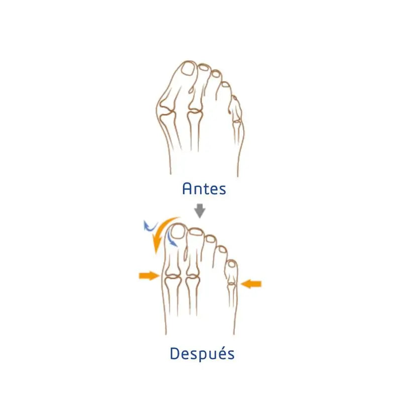 Garcia 1880 Hallux Valgus Korrektor Rechts Größe S/M