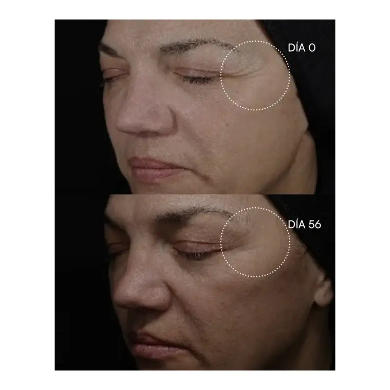 Gema Herrerías 20 Chemisches Peeling 20 Scheiben 23 ml