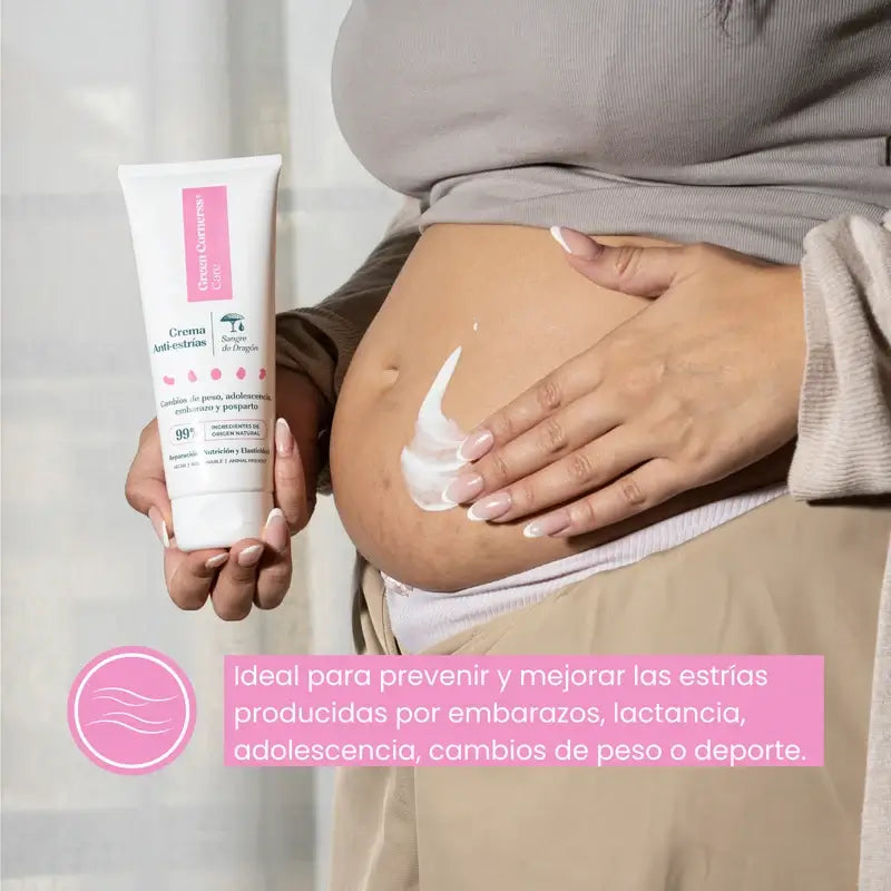 Green Cornerss Drachenblut Anti-Stretch Mark Creme, 200ml