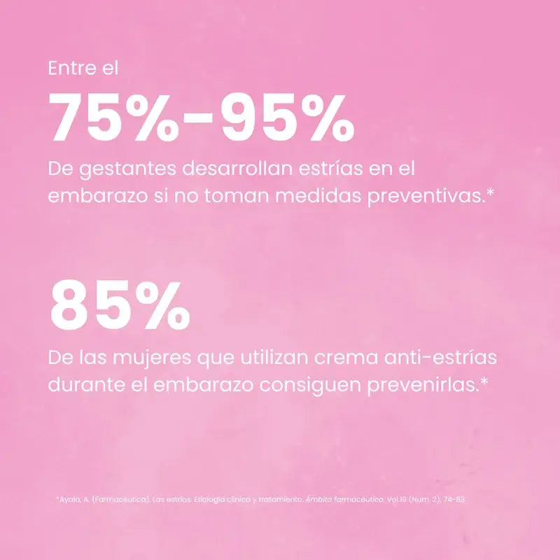 Green Cornerss Drachenblut Anti-Stretch Mark Creme, 200ml