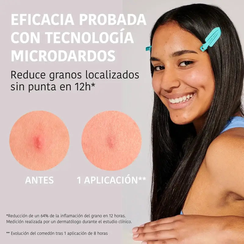 Iroha Nature Acne Prone Skin Patches Microdard Pickel, 12 Stück