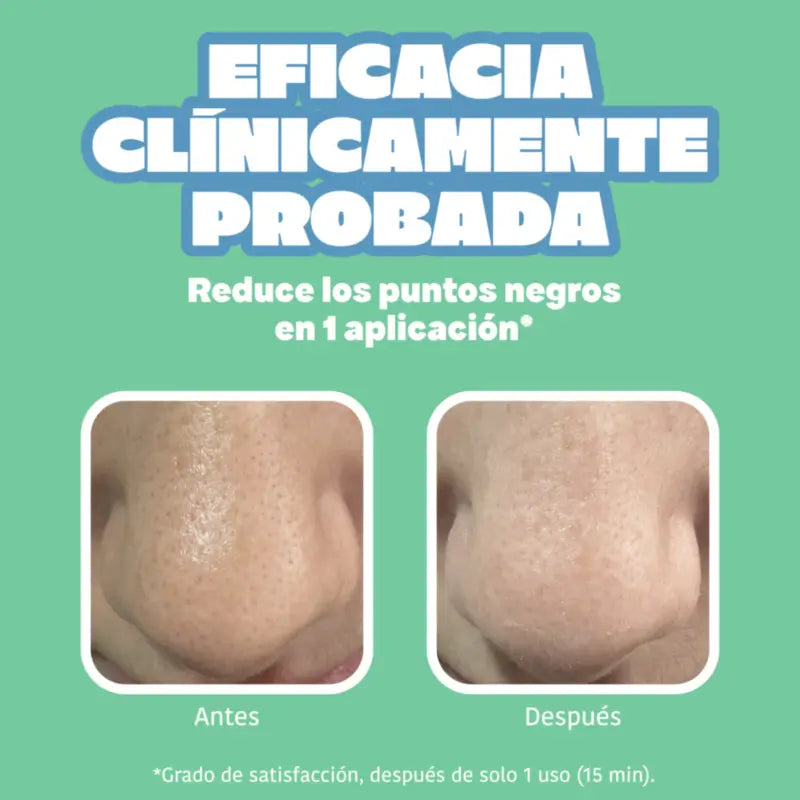 IROHA NATURE Nasenstreifen BYE BYE Dirty Pores – Tiefenreinigung (5 Stück)