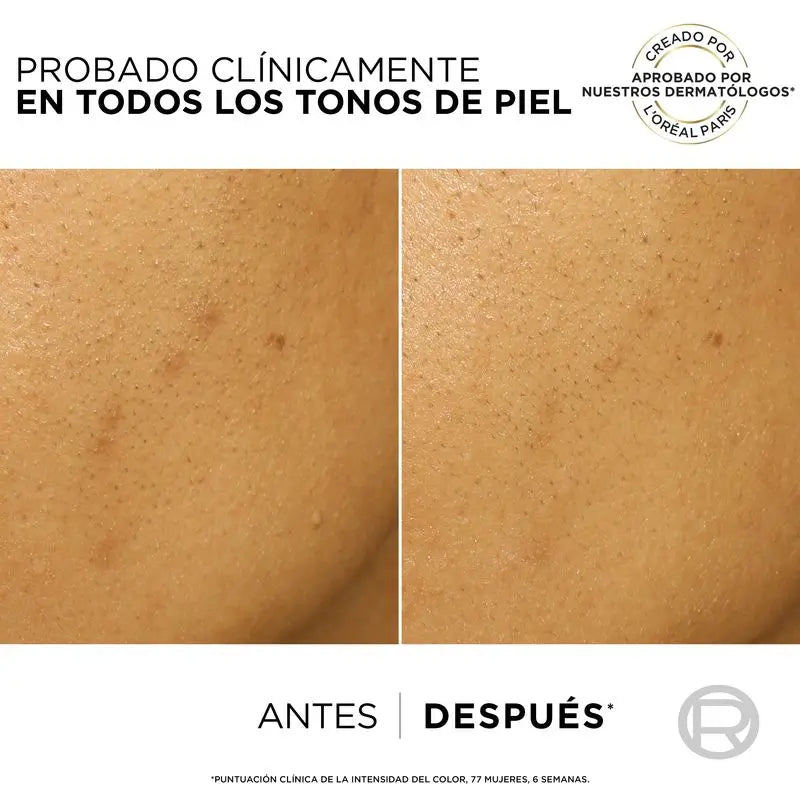 L'Oréal Paris Bright Reveal Anti-Blemish-Peeling