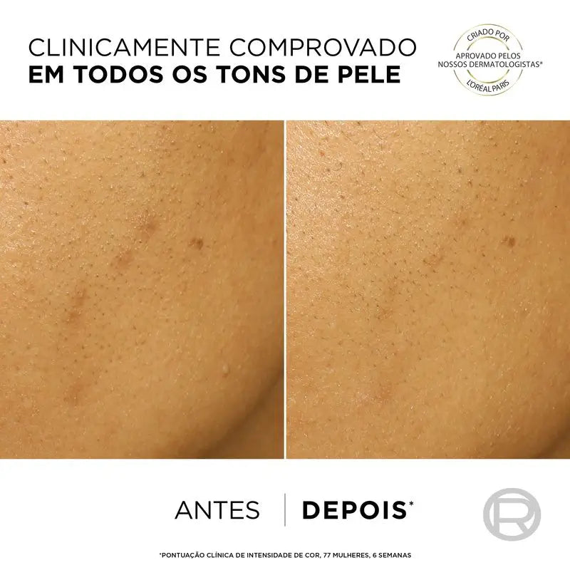 L'Oréal Paris Bright Reveal Anti-Blemish-Peeling