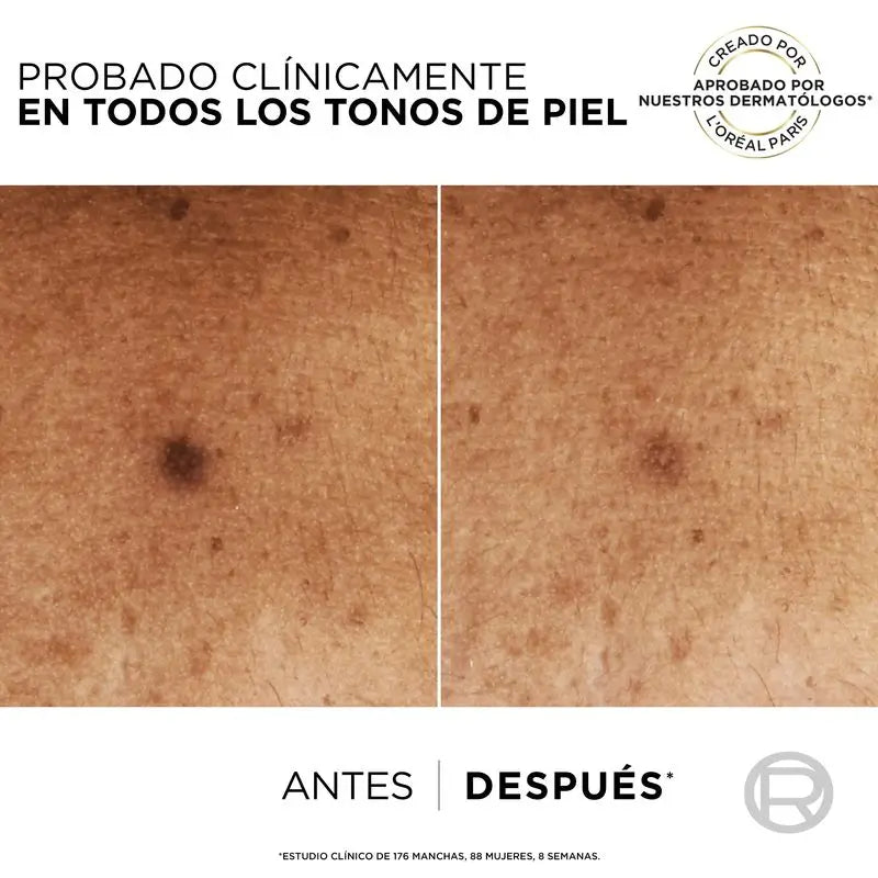 L'Oréal Paris Bright Reveal Niacinamid Anti-Blemish Serum