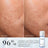Medik8 Press & Klar , 150 ml