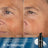 Medik8 Verjüngung Reset Daily Radiance Vit C 50Ml + Crystal Retinal 3 30Ml + Liquid Peptides Deluxe