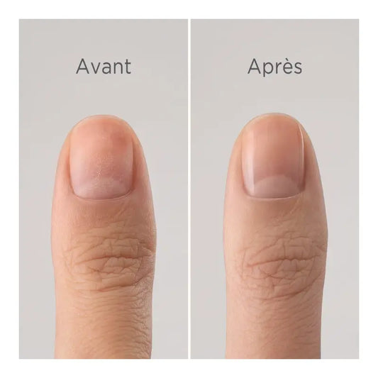 Meme Nagelschutzbasis, 10 ml