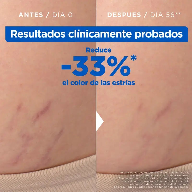 Mixa Anti-Stretch Marks Öl, 100 ml