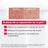Mixa Balm Cica+ Mehrzweck-Reparaturbalsam 50 ml