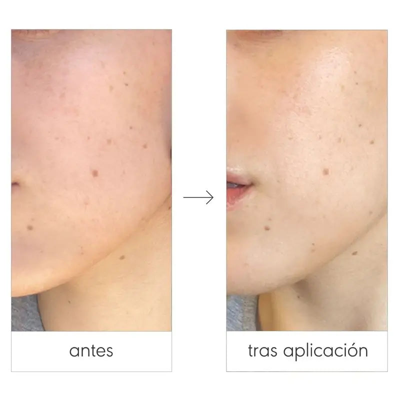 Nieves By Nieves Álvarez Reinigendes Reinigungsgel Total Cleansing Solution, 100 ml