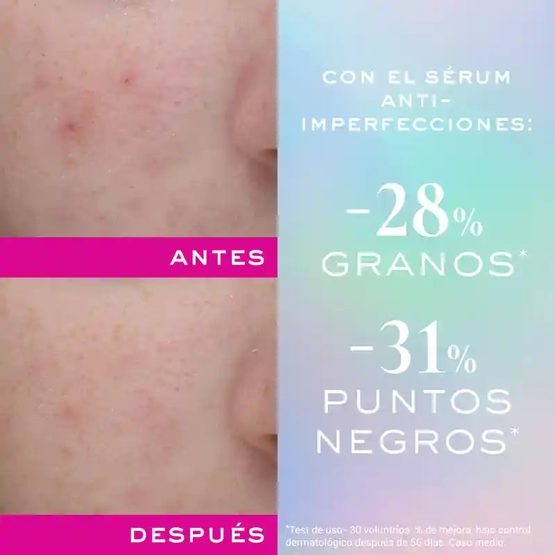 Nuxe Zink Power Anti-Perfektion Serum , 30 ml