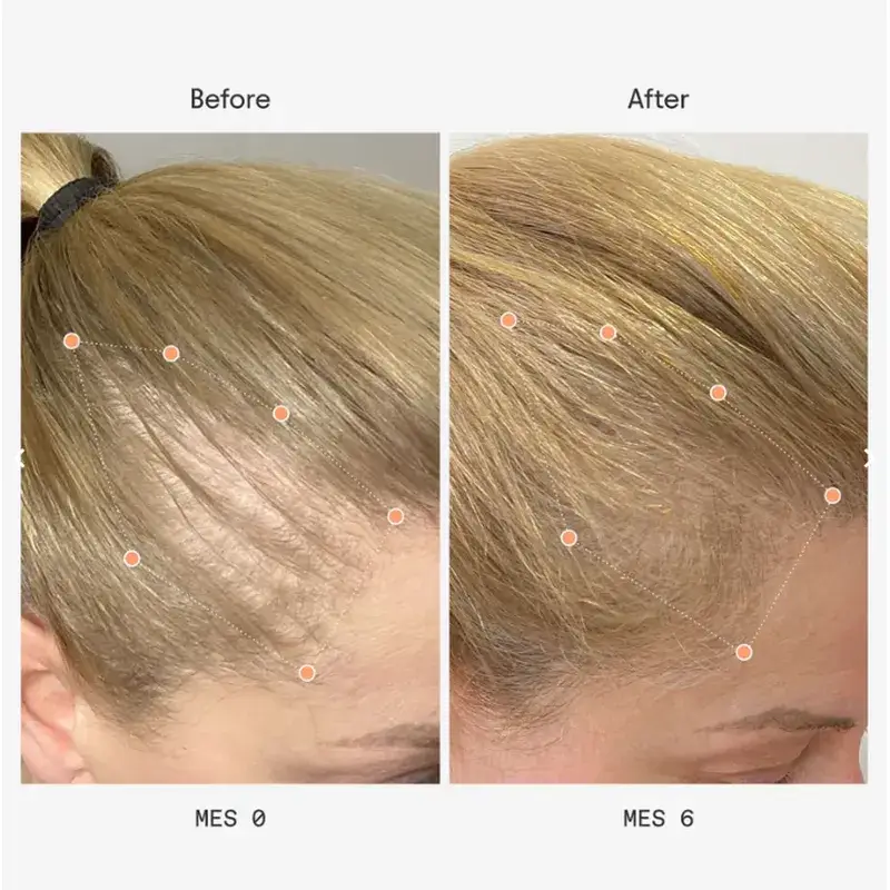 Olistic Next Women, 2 x 28 Fläschchen à 25 ml