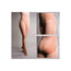Farmalastic Normal Compression Panty With Shaper T.G N