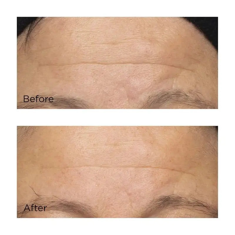 Perricone Cold Plasma Plus+ Der intensive Feuchtigkeitskomplex, 59 ml