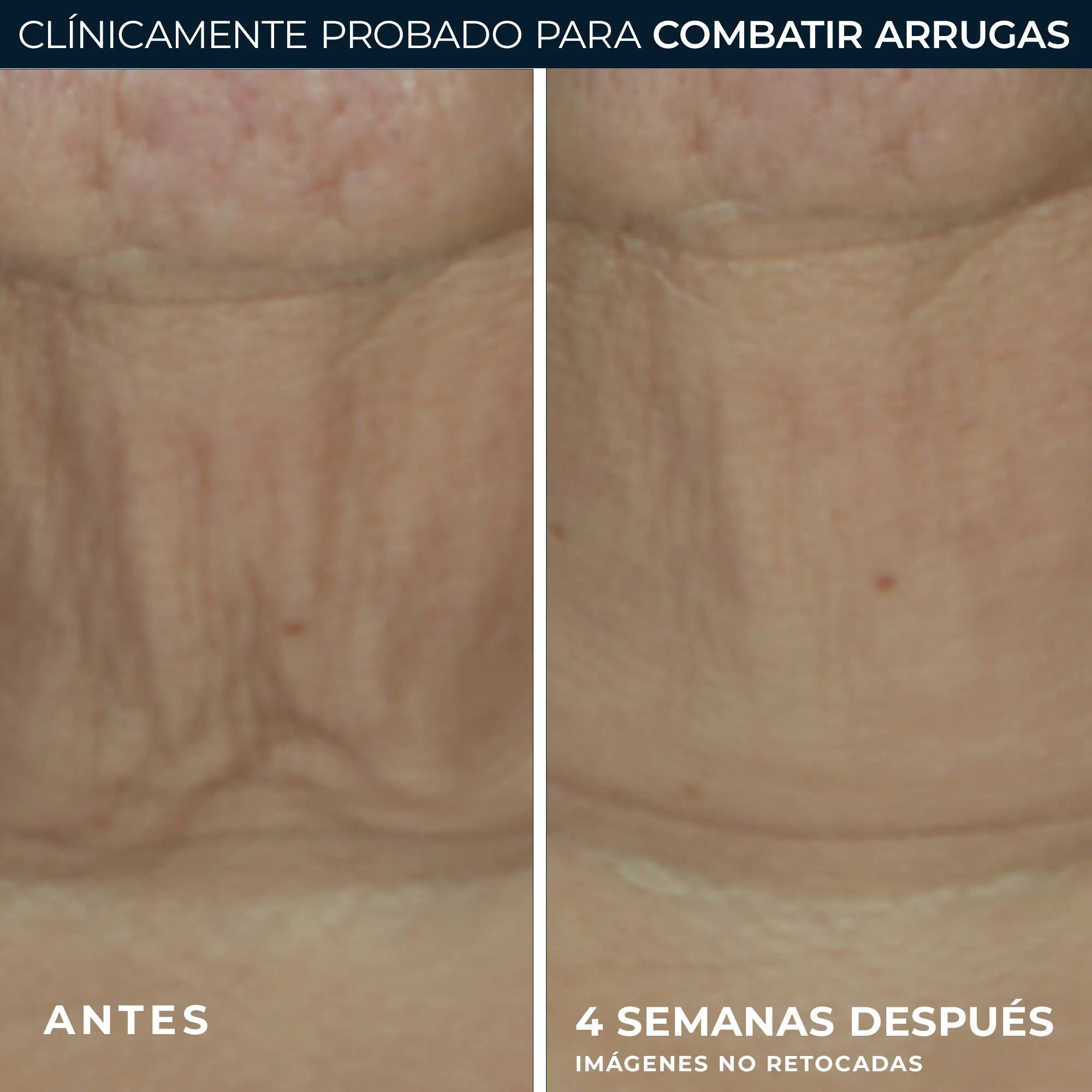 Roc Skincare Iberia Roc® Derm Correxion® Straffender Stick 30G