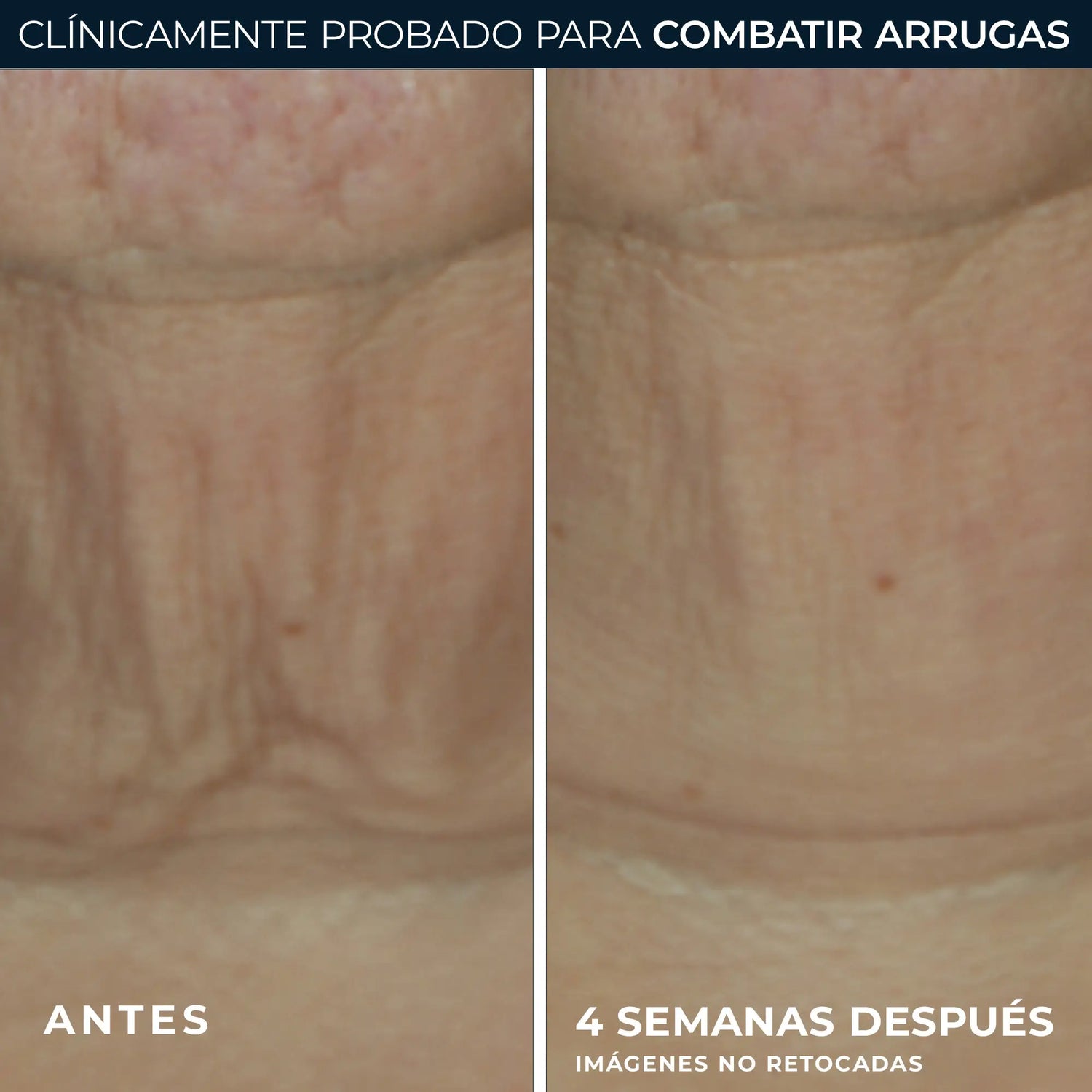Roc Skincare Iberia Roc® Derm Correxion® Straffender Stick 30G