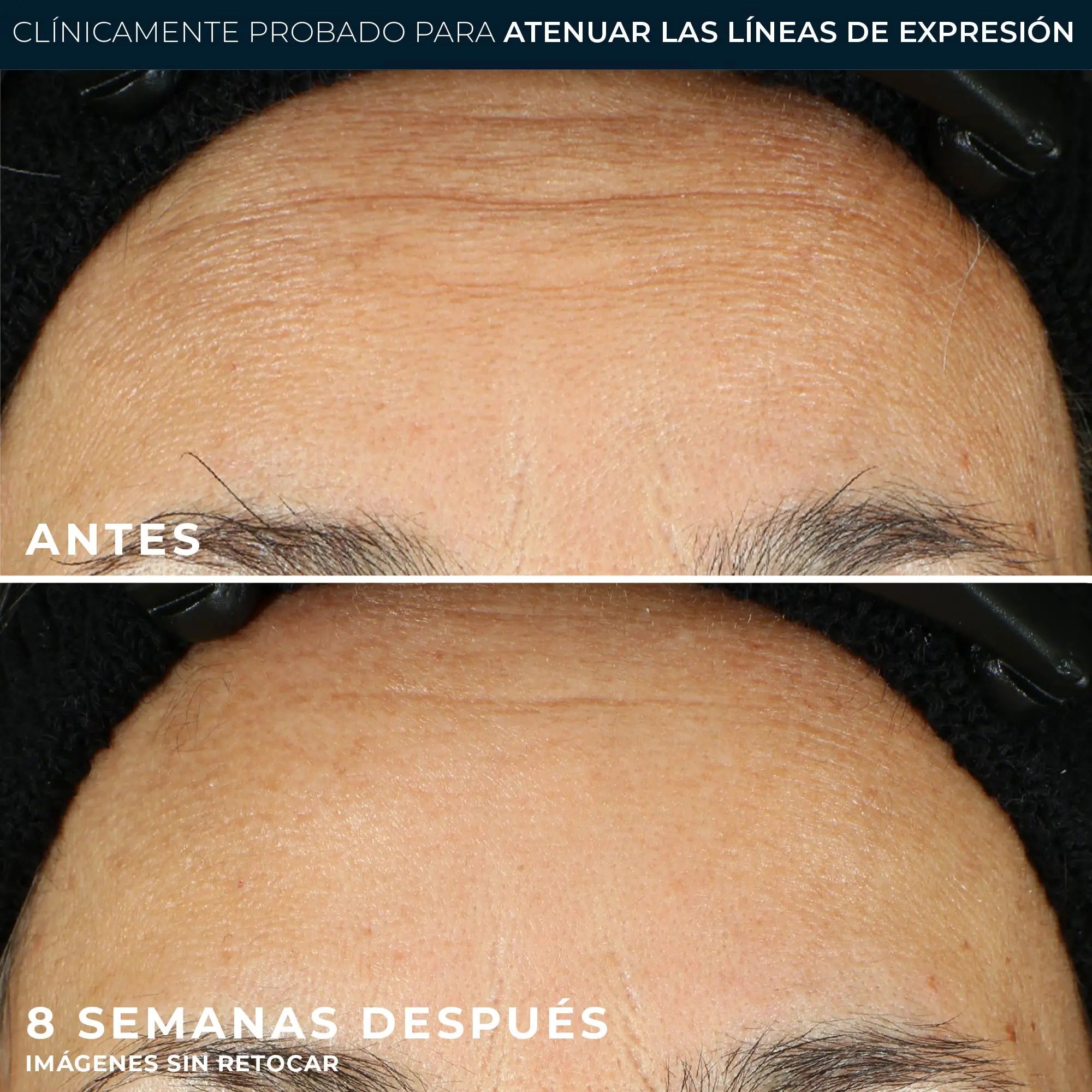 Roc Skincare Iberia Roc® Linie Glättung Serum in Kapseln 30Uds