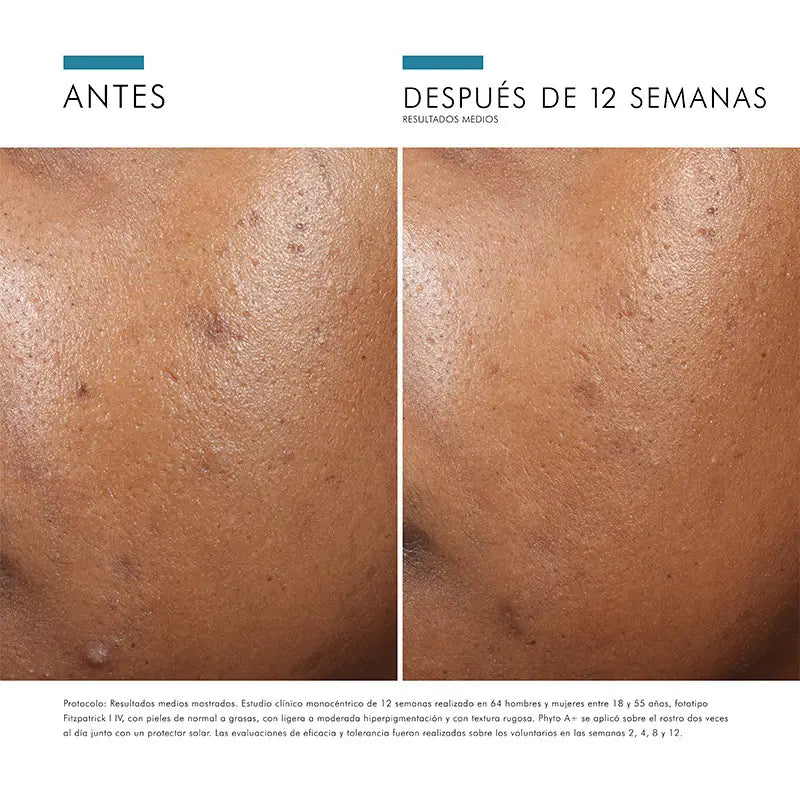SkinCeuticals Phyto A+ Aufhellende Behandlung, 30ml