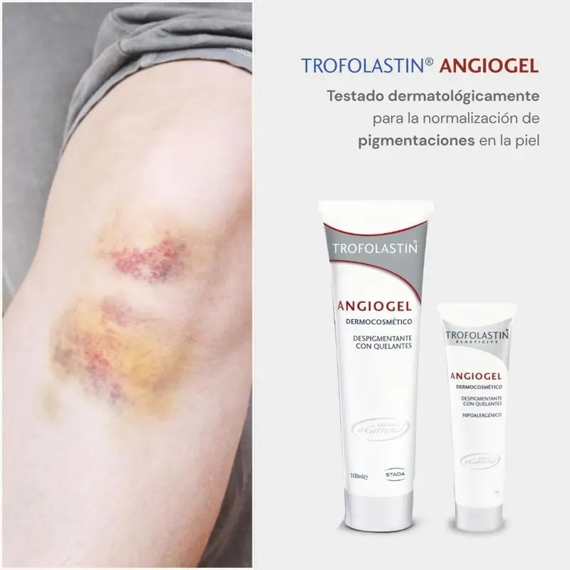 Trofolastin Angiogel Depigmentierungscreme 100 ml