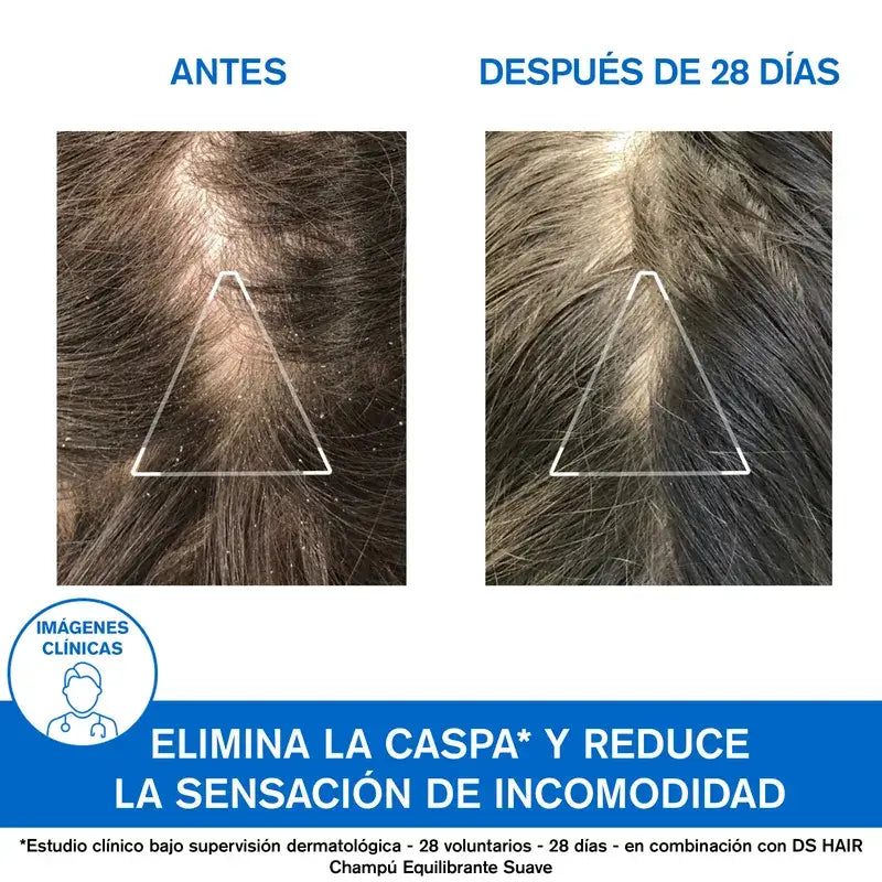 Uriage Ds Haar Anti-Schuppen Behandlung Shampoo 200Ml